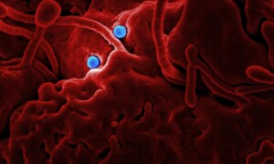 WHO Declares New Respiratory Virus a Public Health Emergency